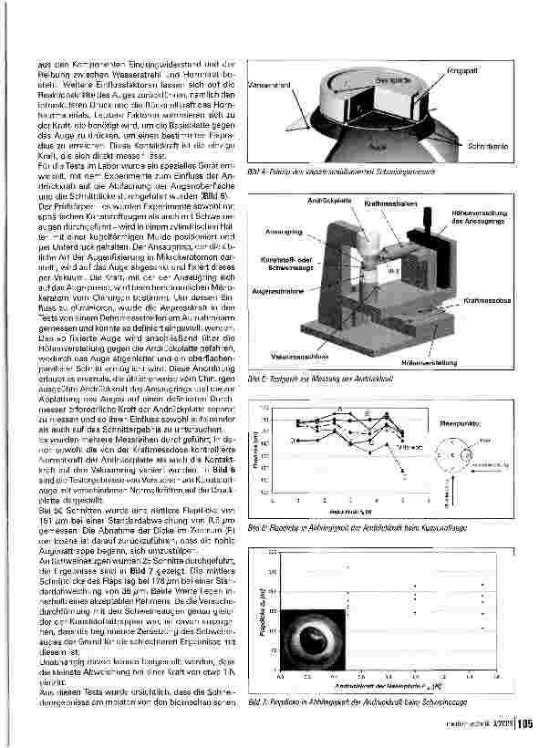 Vorschauseite 3: Hornhautschnitt mit Hochdruck Wasserstrahl für die LASIK-OPLaborversuche mit einem neu entwickelten Mikrokeratom an Kunststoffund Schweineaugen