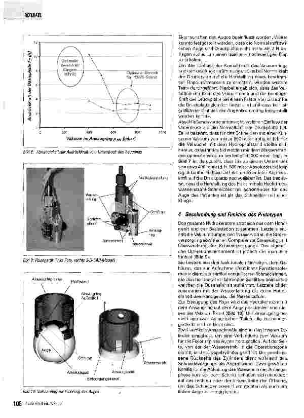 Vorschauseite 4: Hornhautschnitt mit Hochdruck Wasserstrahl für die LASIK-OPLaborversuche mit einem neu entwickelten Mikrokeratom an Kunststoffund Schweineaugen