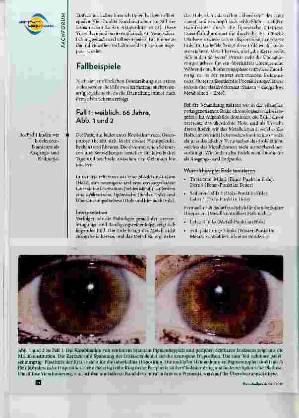 Vorschauseite 3: Akupunktur meets Augendiagnose