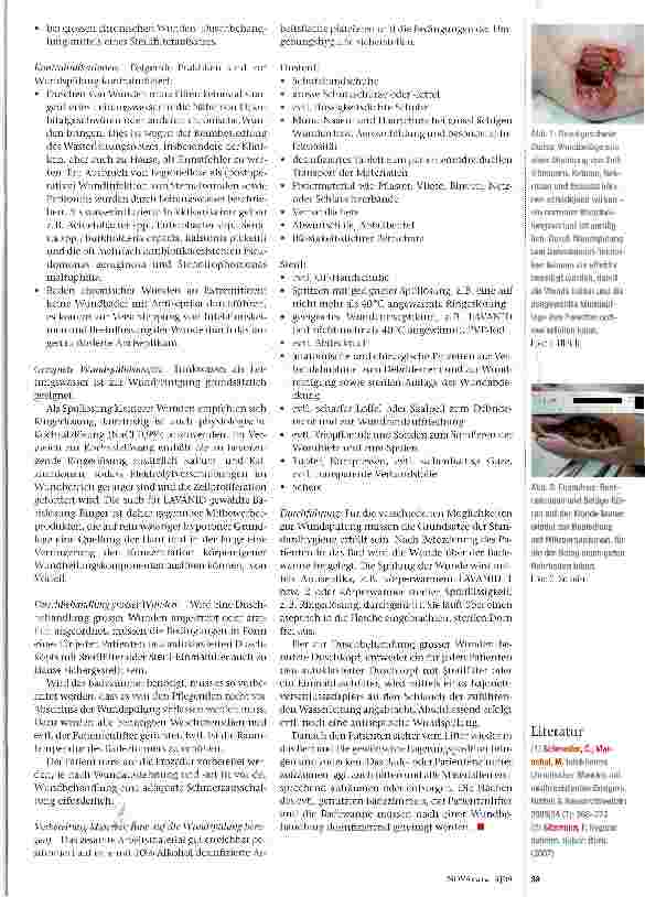 Vorschauseite 2: Spülen chronischer Wunden