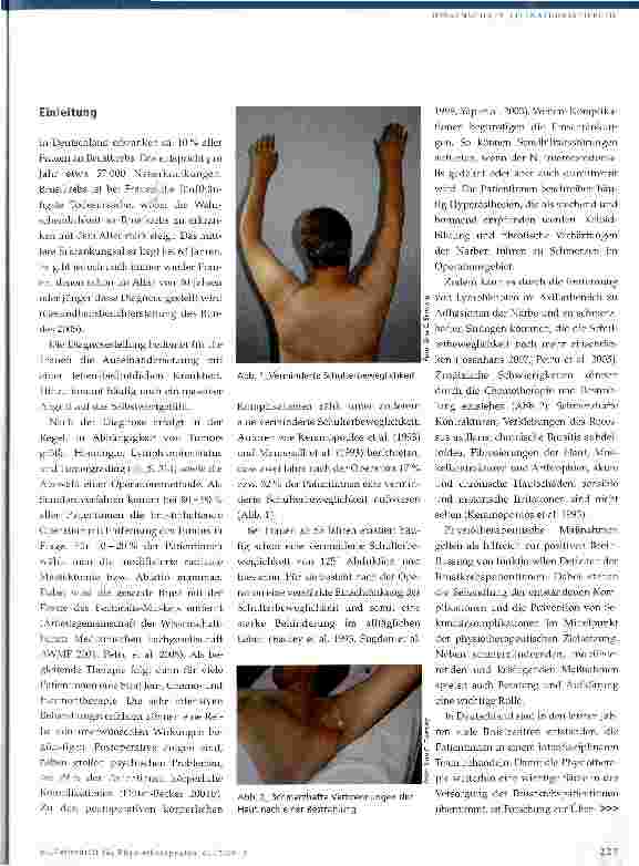 Vorschauseite 2: Der Effekt von Physiotherapie auf die Schulter beweglichkeit nach einer Brustkrebsoperation