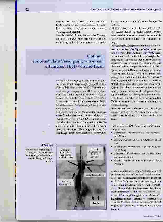 Vorschauseite 6: Präklinische und klinische Versorgung des rupturierten Bauchaortenaneurysmas