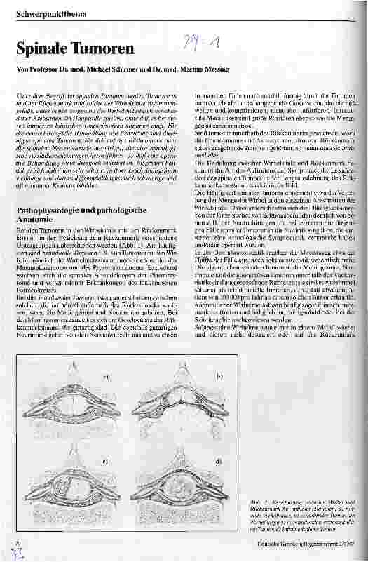 Vorschauseite 1: Spinale Tumoren