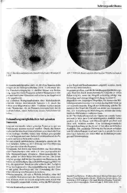 Vorschauseite 4: Spinale Tumoren