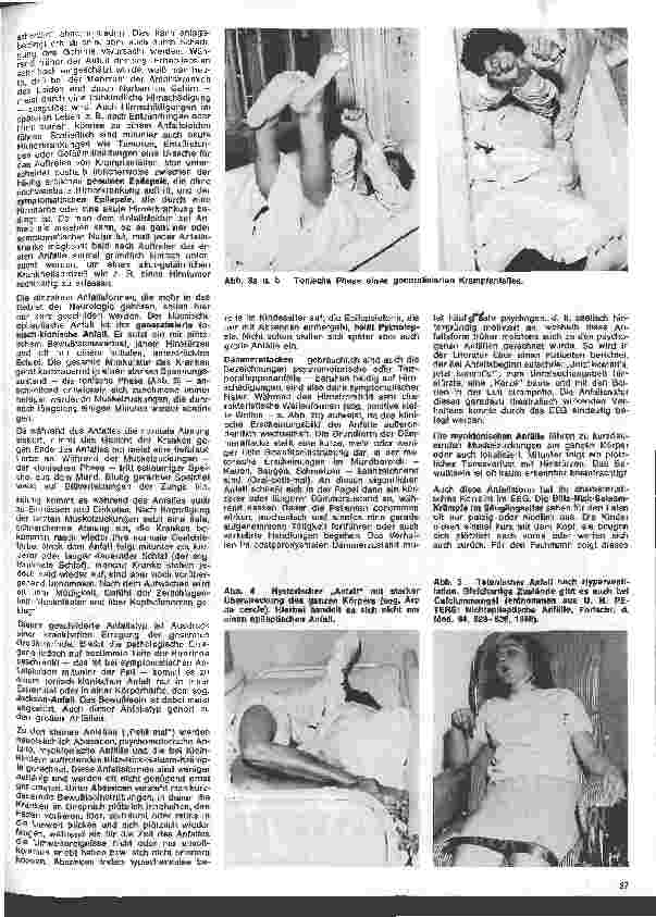 Vorschauseite 2: Die Schwester in der Psychiatrie 19. Folge: Psychiatrische Aspekte der Epilepsie