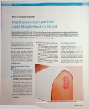 Vorschauseite 1: Die Narbentherapie hält viele Möglichkeiten bereit.