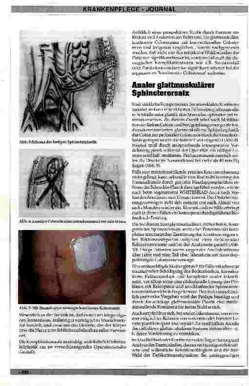 Vorschauseite 3: Die Würzburger Sphincterplastik