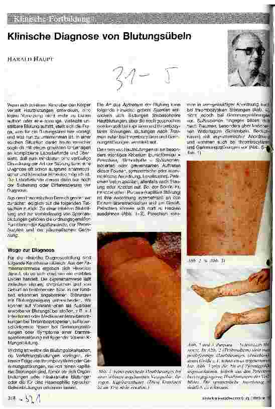 Vorschauseite 1: Klinische Diagnose von Blutungsübeln