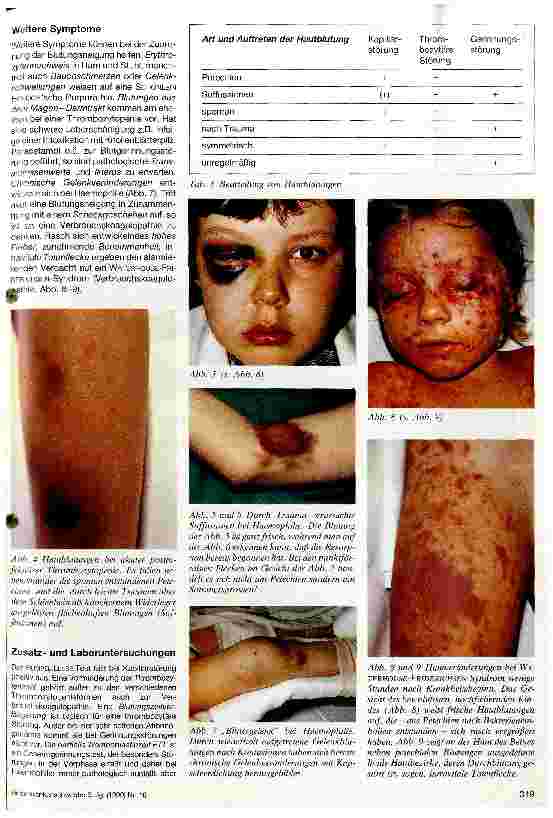 Vorschauseite 2: Klinische Diagnose von Blutungsübeln