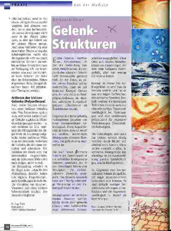 Vorschauseite 3: Arthrose Stummer Verschleiß und schmerzhaftes Leiden