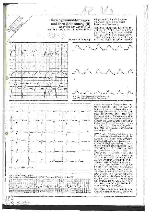 Vorschauseite 1: Herzrhythmusstörungen und ihre Erkennung (II)