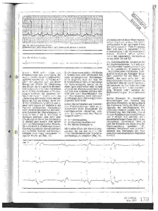 Vorschauseite 2: Herzrhythmusstörungen und ihre Erkennung (II)