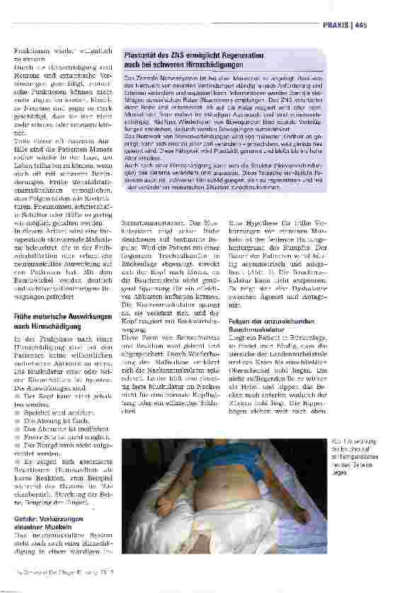 Vorschauseite 2: Bauchwickel fördert patienteneigene Bewegungen