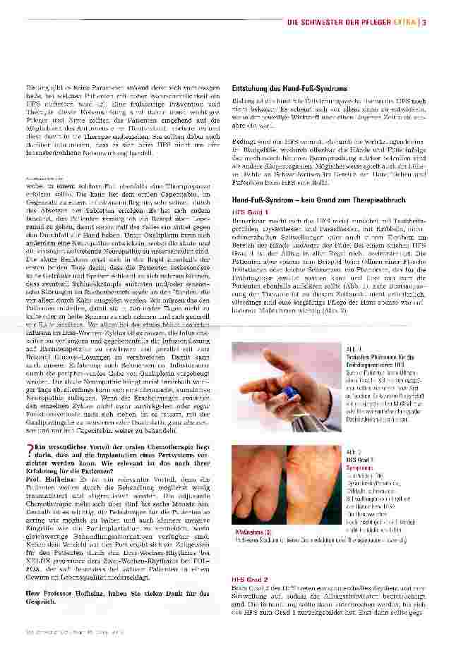 Vorschauseite 3: Der Port ist überflüssig, aber ein Hand-Fuß-Syndrom ist frühzeitig zu behandeln