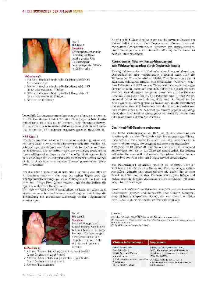 Vorschauseite 4: Der Port ist überflüssig, aber ein Hand-Fuß-Syndrom ist frühzeitig zu behandeln