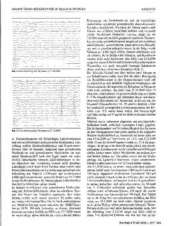 Vorschauseite 2: Lacosamid-Kontrolle epileptischer Anfälle bei hypoxischem Hirnschaden nach Auftreten einer Valproat-induzierten Enzephalopathie