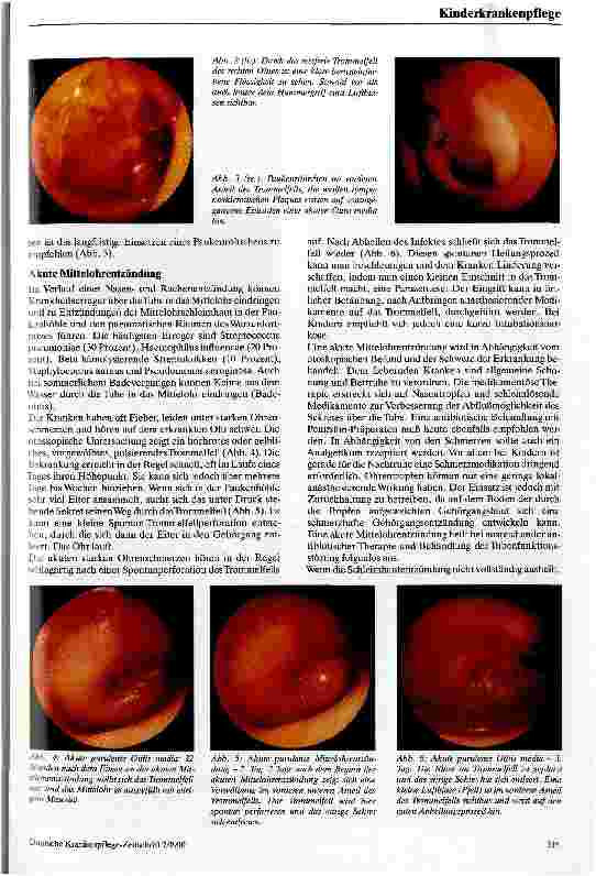 Vorschauseite 2: Otitis media
