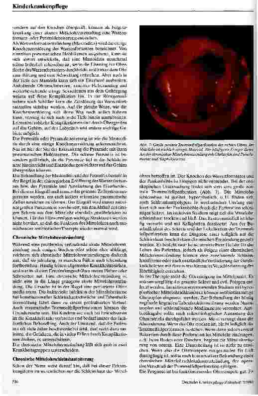 Vorschauseite 3: Otitis media