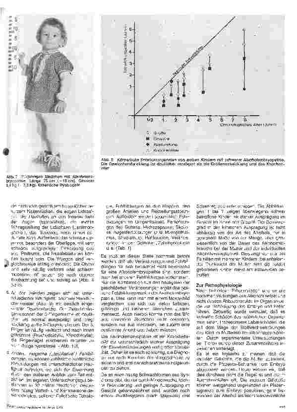 Vorschauseite 4: Alkoholembryopathie und Frauenalkoholismus