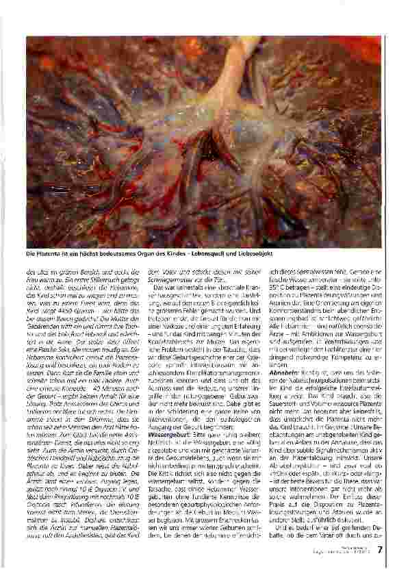 Vorschauseite 4: Zurückhaltung üben