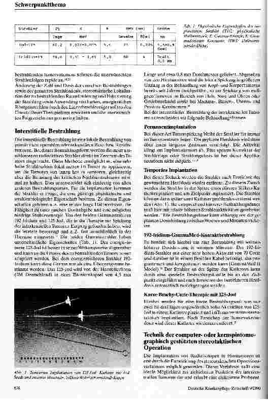 Vorschauseite 2: Interstitielle Bestrahlung von Hirntumoren