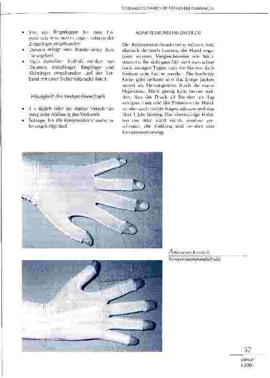 Vorschauseite 6: Verbandstechniken bei Handverbrennungen