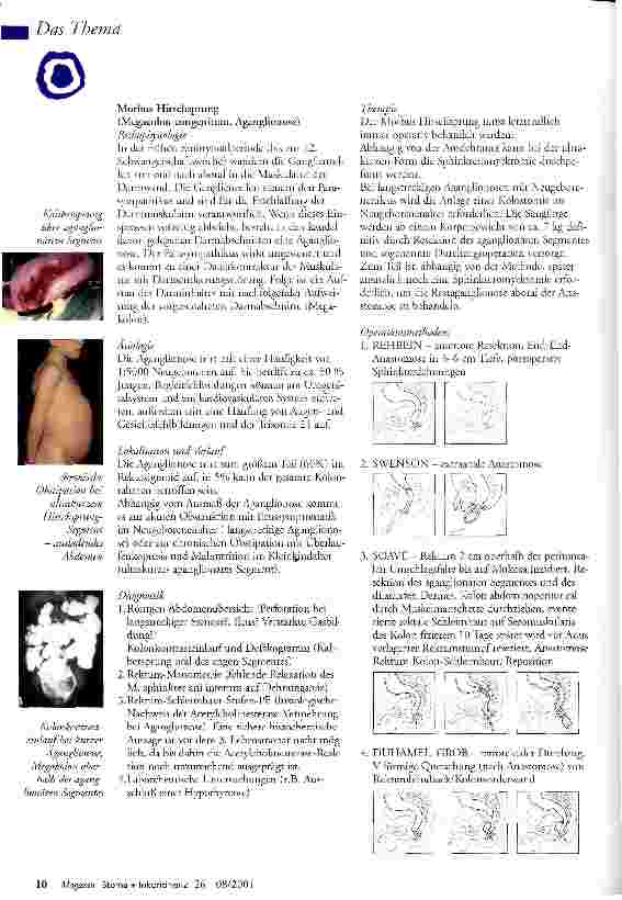 Vorschauseite 2: Enterostoma bei angeborenen und frühkindlich erworbenen Darmerkrankungen