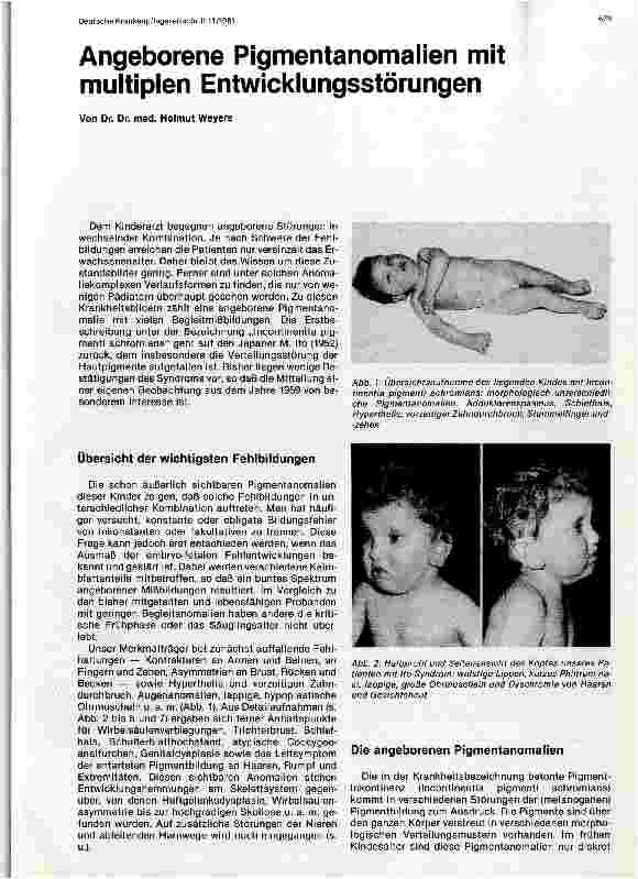 Vorschauseite 1: Angeborene Pigmentanomalien mit multiplen Entwicklungsstörungen