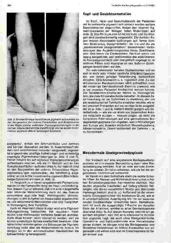 Vorschauseite 2: Angeborene Pigmentanomalien mit multiplen Entwicklungsstörungen