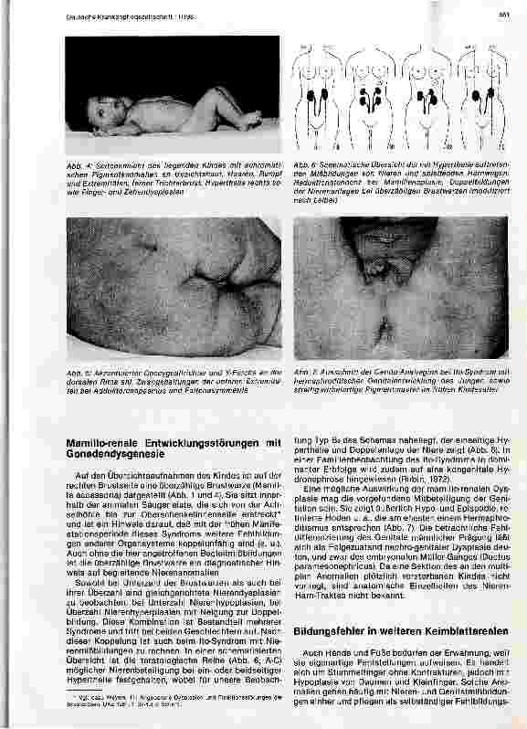 Vorschauseite 3: Angeborene Pigmentanomalien mit multiplen Entwicklungsstörungen