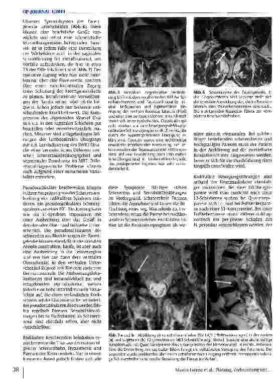 Vorschauseite 5: Planung, Vorbereitung und Nachkontrolle bei Operationen von degenerativen Erkrankungen der Wirbelsäule
