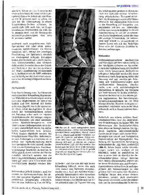 Vorschauseite 6: Planung, Vorbereitung und Nachkontrolle bei Operationen von degenerativen Erkrankungen der Wirbelsäule