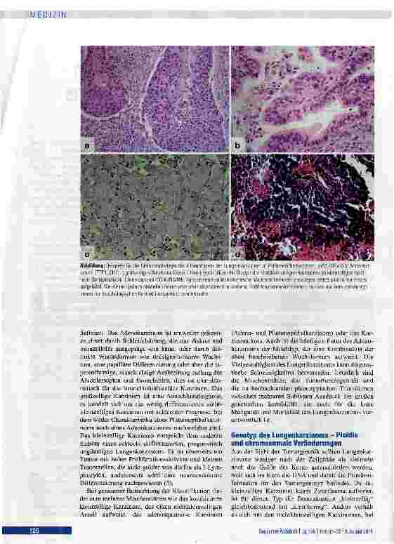 Vorschauseite 2: Morphologische und molekulare Diagnostik des Lungenkarzinoms