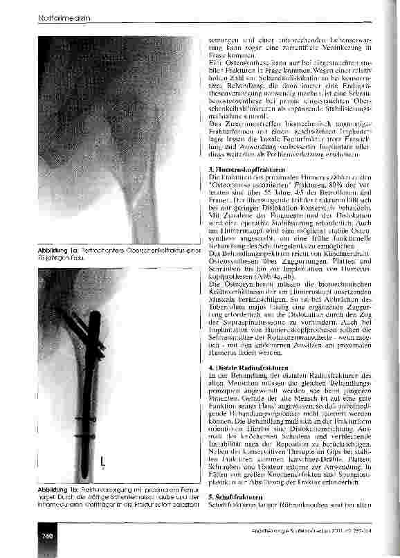 Vorschauseite 4: Trauma im Alter Epidemiologie - Versorgungskonzepte - Prognose