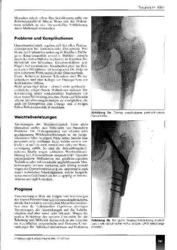 Vorschauseite 5: Trauma im Alter Epidemiologie - Versorgungskonzepte - Prognose