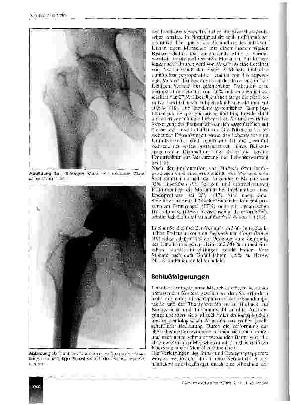 Vorschauseite 6: Trauma im Alter Epidemiologie - Versorgungskonzepte - Prognose