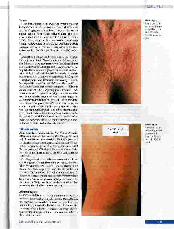 Vorschauseite 3: Lichtdermatosen: Diagnostik und Therapie