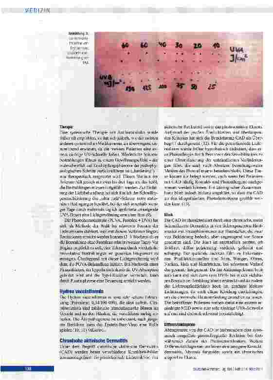 Vorschauseite 4: Lichtdermatosen: Diagnostik und Therapie