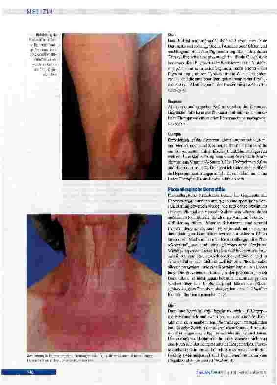 Vorschauseite 6: Lichtdermatosen: Diagnostik und Therapie