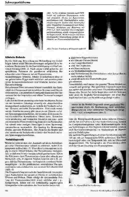 Vorschauseite 4: Behandlungsstrategien bei Thoraxtrauma