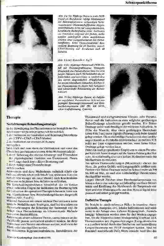 Vorschauseite 5: Behandlungsstrategien bei Thoraxtrauma