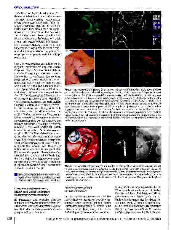 Vorschauseite 3: Intraoperative Navigation und computerassistierte Chirurgie in der MKG-Chirurgie