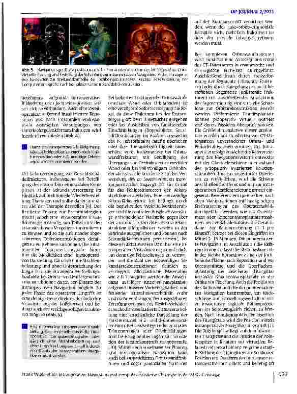 Vorschauseite 4: Intraoperative Navigation und computerassistierte Chirurgie in der MKG-Chirurgie