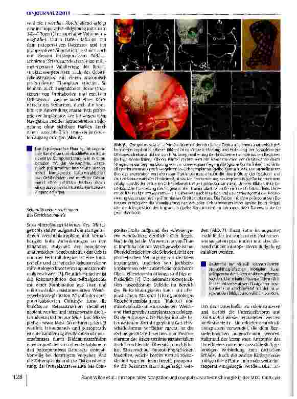 Vorschauseite 5: Intraoperative Navigation und computerassistierte Chirurgie in der MKG-Chirurgie