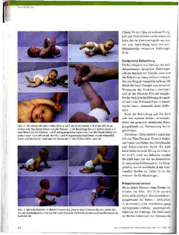 Vorschauseite 3: Physiotherapie bei neurologisch bedingten Bewegungsstörungen im Kindesalter
