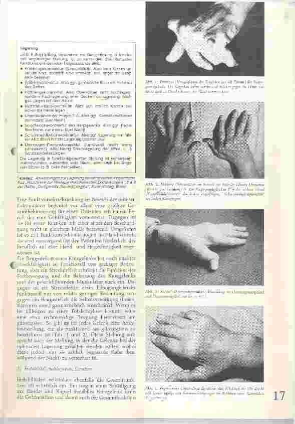 Vorschauseite 2: Funktionelle Probleme bei chroischer Polyarthritis