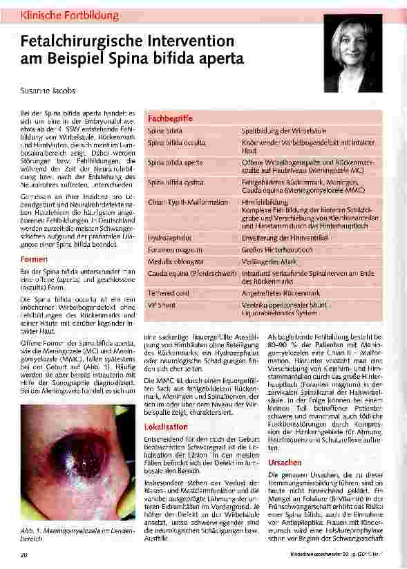 Vorschauseite 1: Fetal chirurgische Intervention am Beispiel Spina bifida aperta