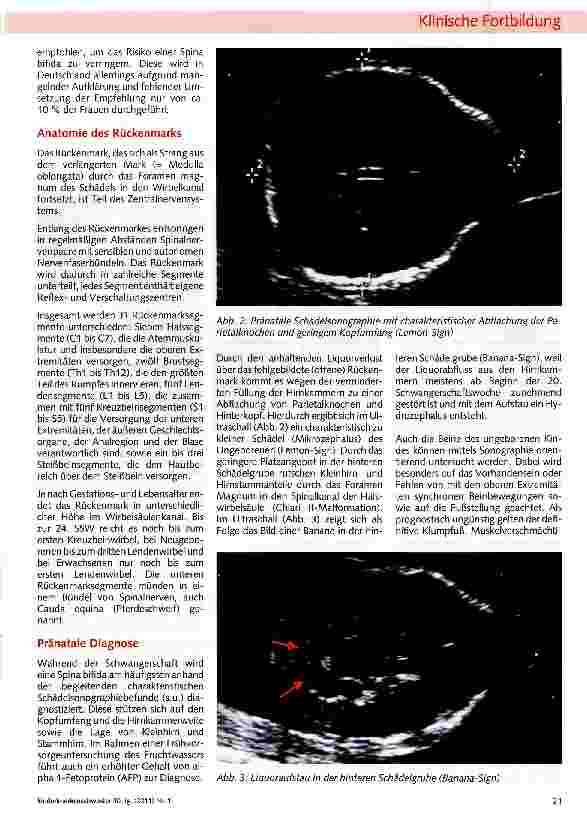 Vorschauseite 2: Fetal chirurgische Intervention am Beispiel Spina bifida aperta