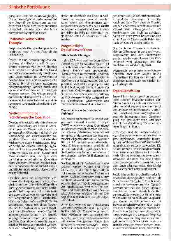Vorschauseite 3: Fetal chirurgische Intervention am Beispiel Spina bifida aperta
