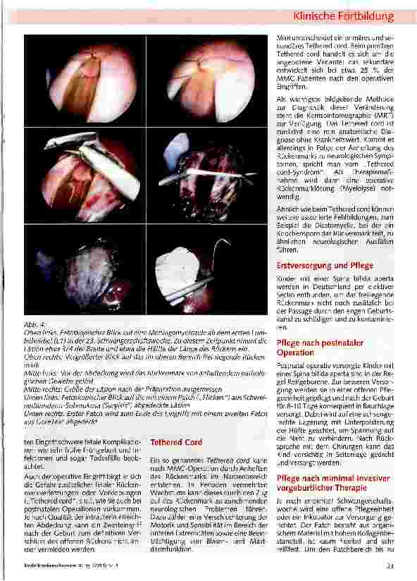 Vorschauseite 4: Fetal chirurgische Intervention am Beispiel Spina bifida aperta